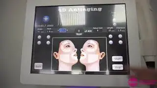 Обзор Hifu Effective lifting