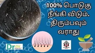பொடுகை சரி செய்ய வீட்டு வைத்தியம் - 100% பொடுகு நீங்கி விடும். திரும்பவும் வராது