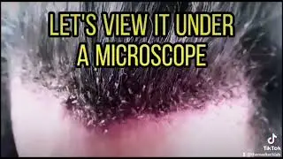 Lice under the microscope 