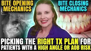 Bite Opening vs Bite Closing Mechanics