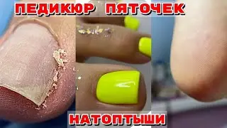 ПЕДИКЮР ДИСКАМИ 🦶 Обработка стоп подробно 🦶Убираем натоптыши