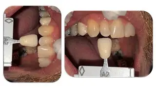 How To Fix Photo Orientation - Dental Lab Photography Guide