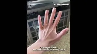 Woman Has A Chip In Her Hand it's so f*cking cool! ⚡️🤯