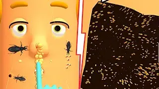 Dr. Pimple Pop - 👨‍⚕️ Popping huge blackheads and Super Satisfying Pimples