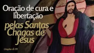 Oração de cura e libertação pelas Santas Chagas de Jesus