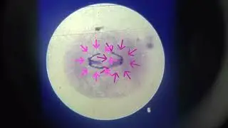 Mitosis in a Micro-Slide-Viewer