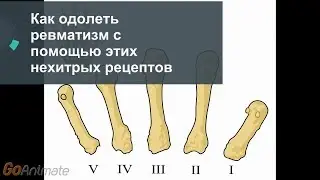 Как одолеть ревматизм с помощью этих нехитрых рецептов