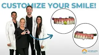 Tooth Gems? Gold Crowns? Tooth Tattoos? Vampire Teeth? - CUSTOMIZE YOUR SMILE!