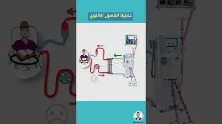عملية الغسيل الكلوي