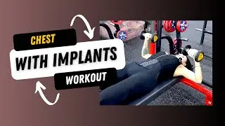 Chest | For Implants Specifically | Weekly Split Workout
