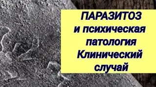 ПАРАЗИТОЗ (ГЕЛЬМИНТОЗ) и панические атаки // Клинический случай.