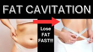 Cavitation machine for Home Use | How to Choose a Cavitation Machine | Cavitation