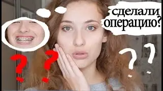ЧТО СО МНОЙ СЛУЧИЛОСЬ???