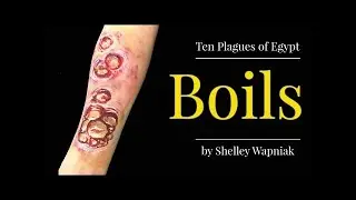 MonkeyPox 0r SmallPox? 7 VIALS GODs Wrath Revelation 16 BOILS LGBT ISRAEL 666 Dark Winter PLAGUE PT1