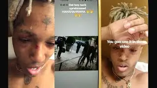 XXXTENTACION TALKS ABOUT HIS RECENT AGGRESSION!