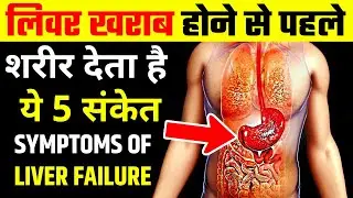 लिवर खराब होने से पहले शरीर देता है ये 5 संकेत | Liver kharab hone ke lakshan