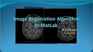 Image Registration : In Matlab