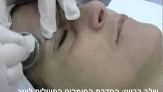 מזותרפיה | מזותרפיה ללא מחטים