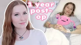 1 year post Hysterectomy for Adenomyosis