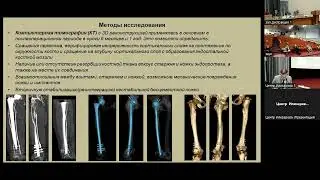 Пивень Игорь Меерович защита 291222г видео mp3