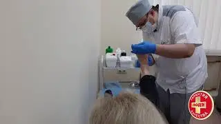 Сухая мозоль