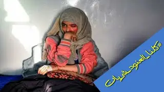 تفاصيل جديدة حول قضية #العنود و عائلتها تطالب من سلطات صنعاء معاقبة الجاني بالمثل || يمن تريندينغ