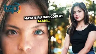 Bikin Pria Tersihir? Gadis Cantik Filipina Ini Memiliki Mata Beda Warna Alami