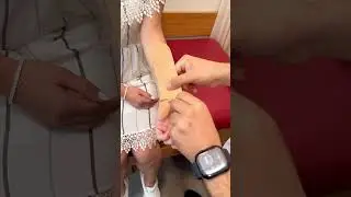 Elde sinir sıkışması için bunu deneyin
