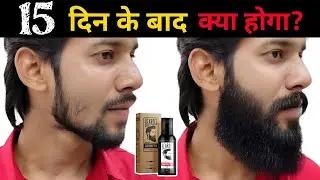 Beardo Beard Hair Growth Oil After 15 Days Review |Best Beard Oil For Patchy Beard in India 2026 !