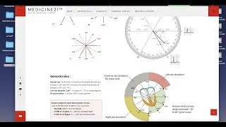 Heart axis deviation and alfa angle