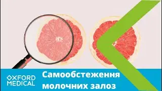 Самообстеження молочних залоз - методика та техніка проведення