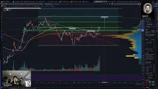 Options Trading - Bitcoin Miners
