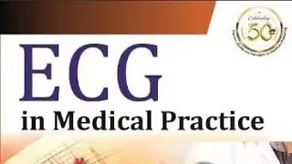 Learn ECG in a Day | Learn ECG in a simple way in urdu/hindi🔥 | #ecg #LEARNECG #mbbs #ecg #medicine