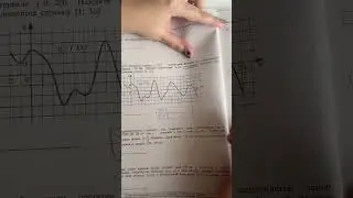 ЕГЭ 2023 года! 7 задача Производные🤪