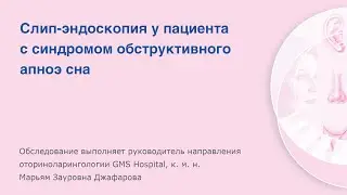 Слип-эндоскопия у пациента с cиндромом обструктивного апноэ сна видеориноларингоскопом KARL STORZ
