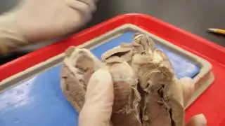 Dissecting a sheep heart (ft. Anthony)