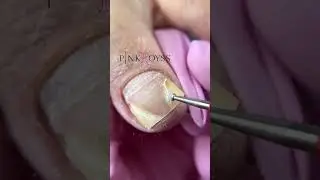 Пенка для педикюра Pink Royss 