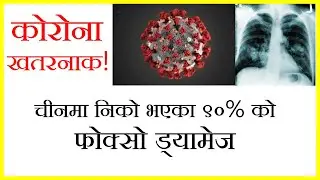 कोरोना संकट! निको भएका ९०% प्रतिसतको फोक्सो ड्यामेज । Corona Update Nepal ।