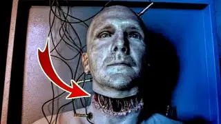 Human Head Transplantation