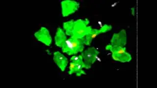 Cluster of IFN-gamma-producing T cells
