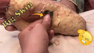 How to removal skin | callus removal skin flakes #47
