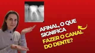 TRATAMENTO DE CANAL - o que é tratamento de canal?