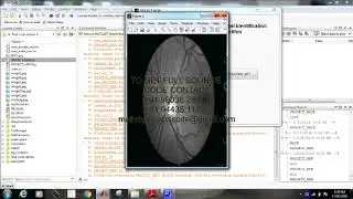 a secure personal identification system based on human retina matlab projects code