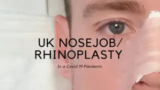 UK NOSEJOB/RHINOPLASTY in the Covid 19 Pandemic.