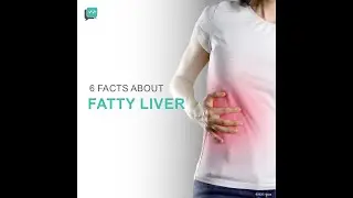 6 Facts About Non-Alcoholic Fatty Liver Disease (NAFLD)