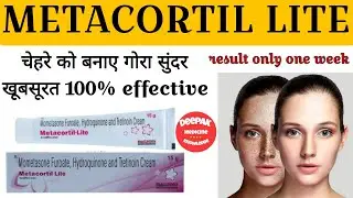 Metacortil Lite Cream Review in Hindi || चेहरे को बनाएं गोरा सुंदर (Result only 1 week) #skinglow