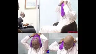 Unveiled - Anas Removes Mask To  Reveal Prosthetic