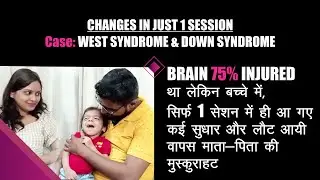 Changes in just 1 Session - West & Down Syndrome | सिर्फ 1 सेशन में, 1 नहीं कई सुधार एक साथ आ गए