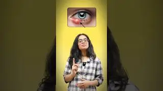 English Vocabulary For Skin Conditions | Medical Words 