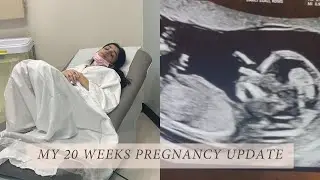 My 20 Weeks HG Pregnancy Update - Nausea, Medications, Ultrasounds etc